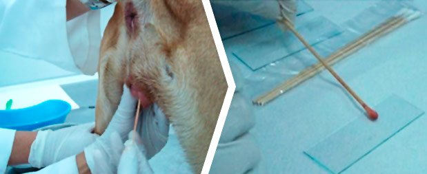 Frotis Vaginal